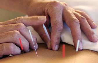 João Finger - Foto 1